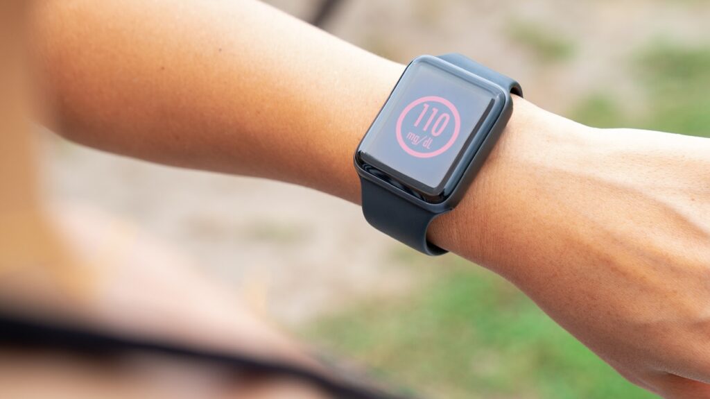 Top Smartwatch Brands in Zimbabwe